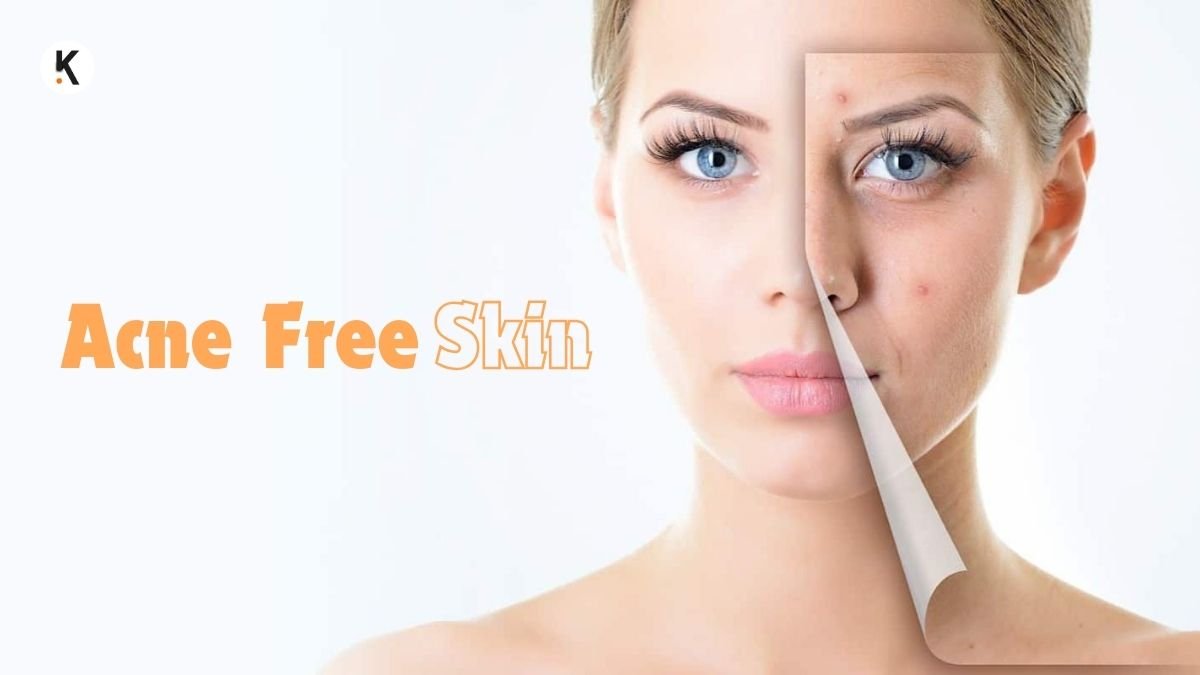 Acne Free Skin