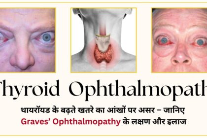 Ophthalmopathy