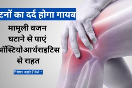 Osteoarthritis and Women